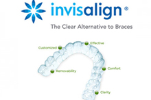 The Invisalign system is a series of clear aligners used to straighten teeth